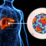 what-is-hepatitis-a-thumbnail