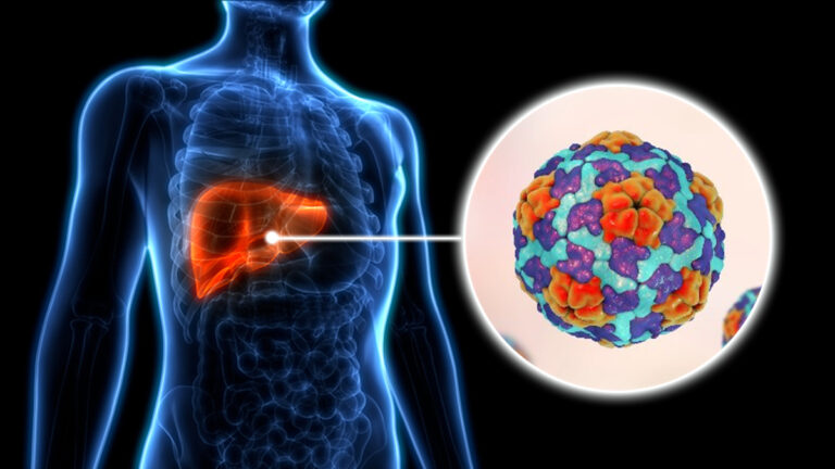 Lesotho’s silent hepatitis burden exposed