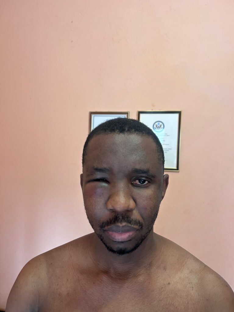Boloetse abduction sends chilling warning to Lesotho’s media